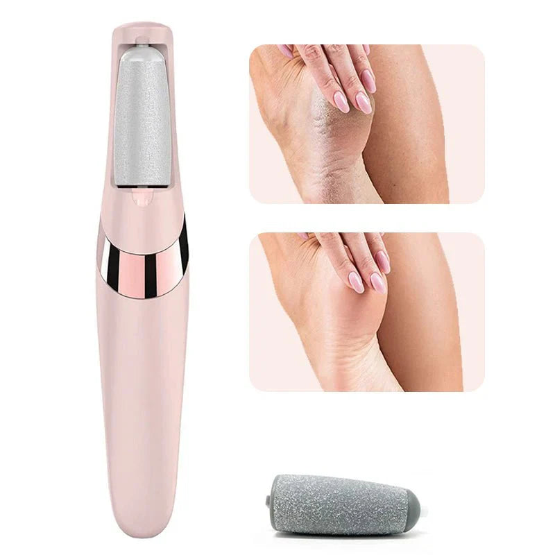 SB Pedicure Callus Remover (Original)
